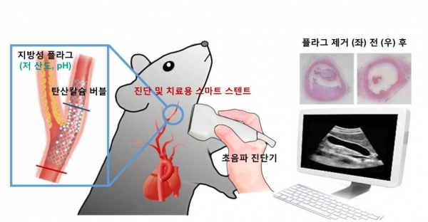 포스텍 신소재공학과 한세광 교수팀은 3D프린팅 기술을 이용한 진단·치료용 스마트 스텐트를 개발했다고 23일 밝혔다. [사진=포스텍]