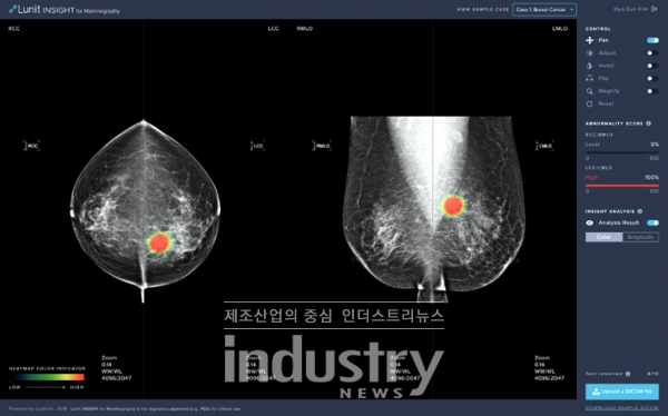 유방암 진단 보조 SW ‘루닛 인사이트 MMG’의 온라인 데모 화면. 누구나 온라인(insight.lunit.io)을 통해 이 SW의 성능을 테스트해볼 수 있다. [사진=루닛]