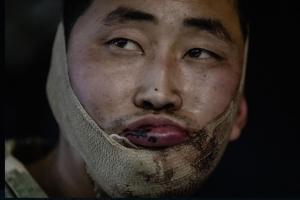 국정원 “러 파병 북한군, 사망자 600명 포함 사상자 4700여명”