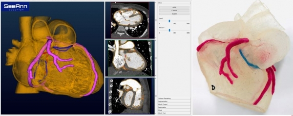더블에이엠과 시안솔루션이 협업 중인 의료영상을 3D로 변환하여 3D 프린터로 출력한 심장 모형 [사진=더블에이엠]