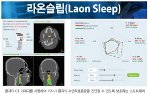 라온피플, 세계최초 AI 융합 전산유체역학 수면무호흡증 진단 SW 공개
